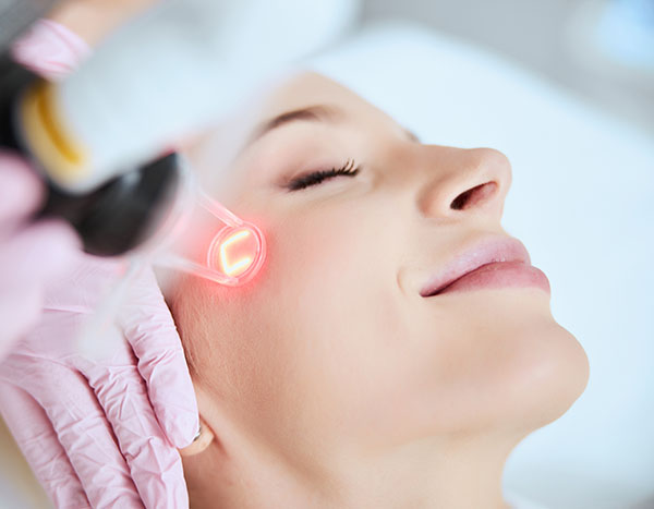 Acne Scar Treatment | Oasis Dermatology