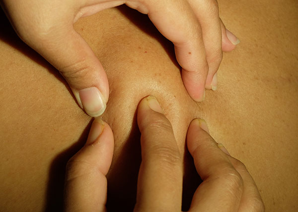 Soft Tissue Swelling Treatment | Oasis Dermatology
