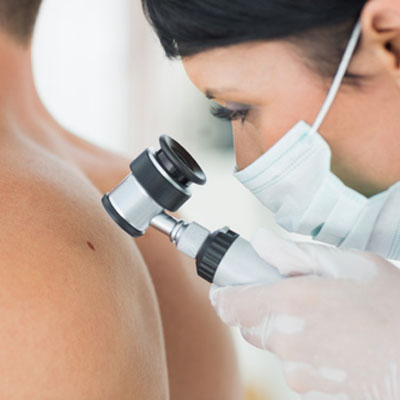 Skin Cancer Removal And Treatment | Mohs Micrographic Surgery