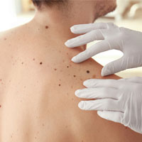 Dermatologist | Oasis Dermatology