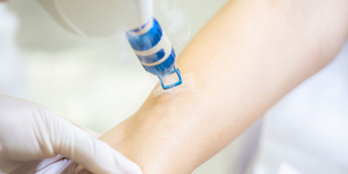 CO2 Laser Resurfacing CO2 Laser Resurfacing | Oasis Dermatology