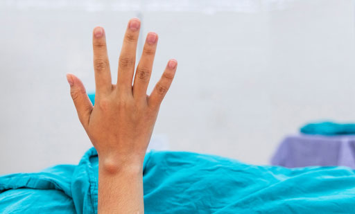 Cyst Drainage And Removal