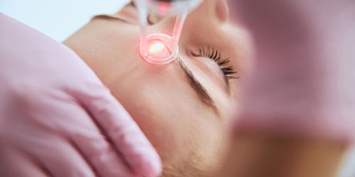 Erbium Laser Resurfacing Erbium Laser Resurfacing | Oasis Dermatology