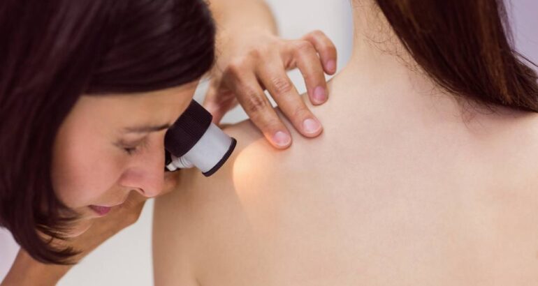 What is Dermatology: Details to Know About This Field